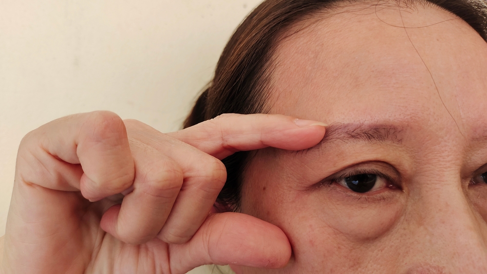 ถุงใต้ตาบอกโรค และการทำงานผิดปกติของร่างกาย