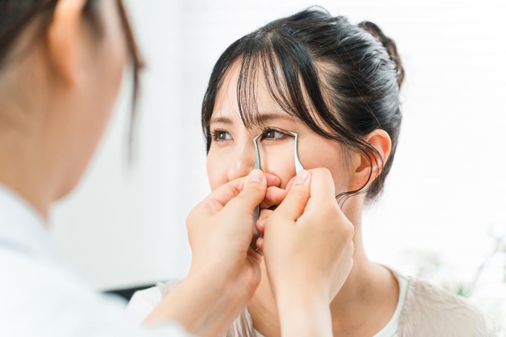 ผู้หญิงเข้ารับการตรวจปัญหาตาสองชั้นข้างเดียวเพื่อวางแผนการรักษาอย่างตรงจุด