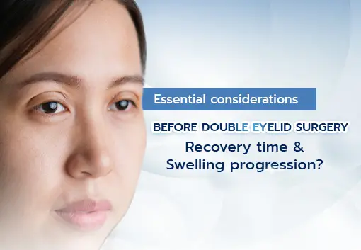 Essential considerations for Double Eyelid Surgery :  Recovery time & swelling progression?