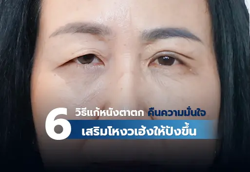 รวม 6 วิธีแก้หนังตาตก คืนความมั่นใจ เสริมโหงวเฮ้งให้ปังขึ้น