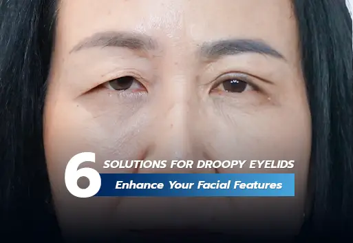 6 solutions for droopy eyelids and enhance facial harmony