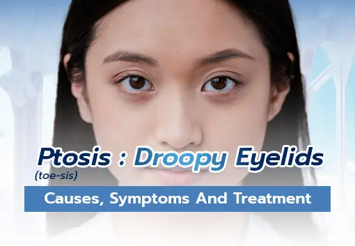 What Causes Ptosis? Causes, Symptoms, and Treatment of Droopy Eyelids.