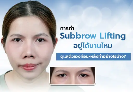 Subbrow Lifting Care Tips: Before & After, for Longer-Lasting Results.