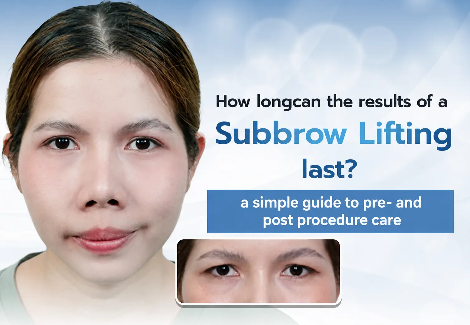 Subbrow Lifting Care Tips: Before & After, for Longer-Lasting Results.