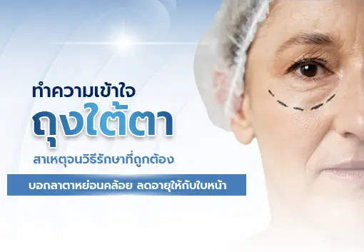 Understanding eye bags, their causes, and the correct treatment methods.