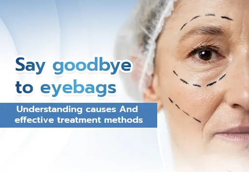 Understanding eye bags, their causes, and the correct treatment methods.