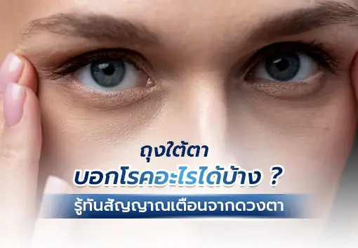 ถุงใต้ตาบอกโรคอะไรได้บ้าง ? รู้ทันสัญญาณเตือนจากดวงตา