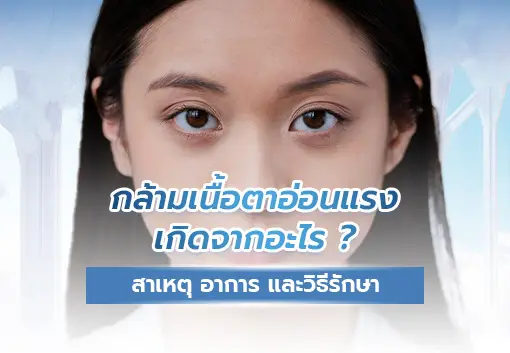 What Causes Ptosis? Causes, Symptoms, and Treatment of Droopy Eyelids.