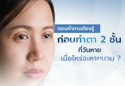 Essential considerations for Double Eyelid Surgery :  Recovery time & swelling progression?